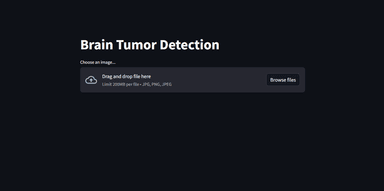 Brain Tumor Detection on MRI Images